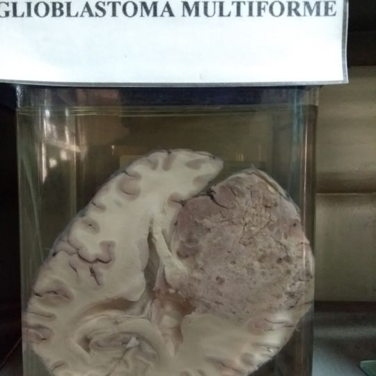 Museo del Cerebro